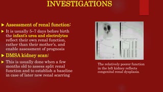 INVESTIGATIONS
 Assessment of renal function:
 It is usually 5–7 days before birth
the infant’s urea and electrolytes
reflect their own renal function,
rather than their mother’s, and
enable assessment of prognosis
 DMSA kidney scan:
 This is usually done when a few
months old to assess split renal
function and to establish a baseline
in case of later new renal scarring
The relatively poorer function
in the left kidney reflects
congenital renal dysplasia.
 