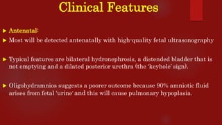 Clinical Features
 Antenatal:
 Most will be detected antenatally with high-quality fetal ultrasonography
 Typical features are bilateral hydronephrosis, a distended bladder that is
not emptying and a dilated posterior urethra (the ‘keyhole’ sign).
 Oligohydramnios suggests a poorer outcome because 90% amniotic fluid
arises from fetal ‘urine’ and this will cause pulmonary hypoplasia.
 