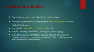 Tuberculous Uveitis
 Causative organism: Mycobacterium tuberculosis
 Primary infection in lung which spreads via bloodstream to other
parts of the body.
 HALLMARK : Necrotising granuloma formation
 In eye, TB mostly presents as uveitis (rich blood supply)
 In endemic areas, it affects all age groups and cause severe
disease, whereas in non endemic areas it affects elderly people
who are immunocompromised.
 