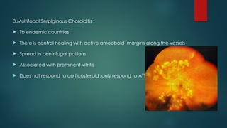 3.Multifocal Serpiginous Choroiditis :
 Tb endemic countries
 There is central healing with active amoeboid margins along the vessels
 Spread in centrifugal pattern
 Associated with prominent vitritis
 Does not respond to corticosteroid ,only respond to ATT
 