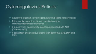 Cytomegalovirus Retinitis
 Causative organism : cytomegalovirus/HHV5 (Beta Herpesviridae)
 This is usually asymptomatic and manifests only in
immunocompromised individuals
 It is a common opportunistic infection associated with AIDS
(CD4count<50)
 It can affect affect various organs such as LUNGS, CNS, SKIN and
EYES
 