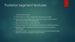 Posterior segment features
1. Retinitis and Vasculitis
 Initially there is a solitary white lesion with granular borders
 Associated with vasculitis which eventually causes FLAME shaped
hemorrhages (PIZZA PIE appearance)
 Macular involvement causes vision loss
 Initially unilateral, but later progresses to become a bilateral disease
 INDOLENT FORM : peripheral granular opacities with occasional
hemorrhage
 FULMINANT FORM : Vast areas of necrosis with prominent hemorrhages
along with areas of progressive retinal atrophy
 