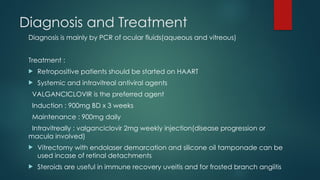 Diagnosis and Treatment
Diagnosis is mainly by PCR of ocular fluids(aqueous and vitreous)
Treatment :
 Retropositive patients should be started on HAART
 Systemic and intravitreal antiviral agents
VALGANCICLOVIR is the preferred agent
Induction : 900mg BD x 3 weeks
Maintenance : 900mg daily
Intravitreally : valganciclovir 2mg weekly injection(disease progression or
macula involved)
 Vitrectomy with endolaser demarcation and silicone oil tamponade can be
used incase of retinal detachments
 Steroids are useful in immune recovery uveitis and for frosted branch angiitis
 