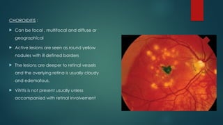 CHOROIDITIS :
 Can be focal , multifocal and diffuse or
geographical
 Active lesions are seen as round yellow
nodules with ill defined borders
 The lesions are deeper to retinal vessels
and the overlying retina is usually cloudy
and edematous.
 Vitritis is not present usually unless
accompanied with retinal involvement
 
