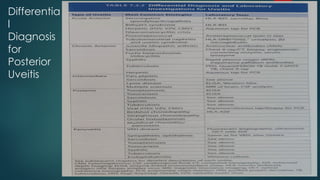 Differentia
l
Diagnosis
for
Posterior
Uveitis
 