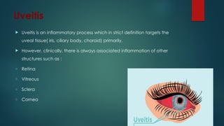 Uveitis
 Uveitis is an inflammatory process which in strict definition targets the
uveal tissue( iris, ciliary body, choroid) primarily.
 However, clinically, there is always associated inflammation of other
structures such as :
o Retina
o Vitreous
o Sclera
o Cornea
 