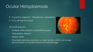 Ocular Histoplasmosis
 Causative organism : Histoplasma capsulatum
 It is a dimorphic fungus
OCULAR features :
o Multiple white atrophic chorioretinal spots
o Peripapillary atrophy
o Absent vitritis
o Choroidal neovascularization is a late feature which can cause
accumulation of subretinal fluid and hemorrhage
 