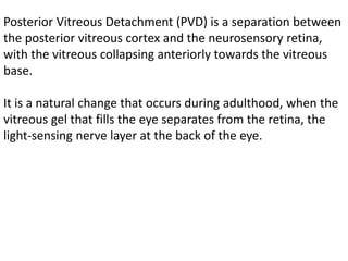 Vitreous Separation - Retina Vitreous Consultants, Inc