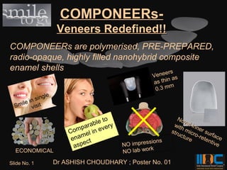 COMPONEERs-
                    Veneers Redefined!!
COMPONEERs are polymerised, PRE-PREPARED,
radio-opaque, highly filled nanohybrid composite
enamel shells                           ers
                                                  Vene as
                                                         n
                                                  as thi
                                                          m
                                                   0.3 m
              le
       in sing
  Smile visit

                                  to                        No
                               ble ry                          v
                                                          wit el inn
                           para eve                          h
                       Com el in                         stru micr er sur
                           m                                 ctu o-re face
                        ena ct                  ssions
                                                                 re  ten
                                                                        tive
                            e           NO impre
                         asp                     rk
  ECONOMICAL                            NO lab wo
Slide No. 1        Dr ASHISH CHOUDHARY ; Poster No. 01
 