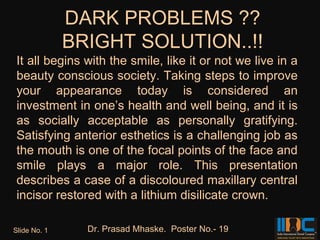 DARK PROBLEMS ??
              BRIGHT SOLUTION..!!
 It all begins with the smile, like it or not we live in a
 beauty conscious society. Taking steps to improve
 your appearance today is considered an
 investment in one’s health and well being, and it is
 as socially acceptable as personally gratifying.
 Satisfying anterior esthetics is a challenging job as
 the mouth is one of the focal points of the face and
 smile plays a major role. This presentation
 describes a case of a discoloured maxillary central
 incisor restored with a lithium disilicate crown.

Slide No. 1     Dr. Prasad Mhaske. Poster No.- 19
 