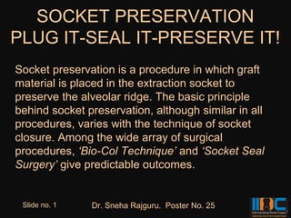 SOCKET PRESERVATION
PLUG IT-SEAL IT-PRESERVE IT!
Socket preservation is a procedure in which graft
material is placed in the extraction socket to
preserve the alveolar ridge. The basic principle
behind socket preservation, although similar in all
procedures, varies with the technique of socket
closure. Among the wide array of surgical
procedures, ‘Bio-Col Technique’ and ‘Socket Seal
Surgery’ give predictable outcomes.


 Slide no. 1   Dr. Sneha Rajguru. Poster No. 25
 