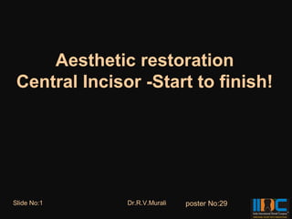 Aesthetic restoration
 Central Incisor -Start to finish!




Slide No:1     Dr.R.V.Murali   poster No:29
 