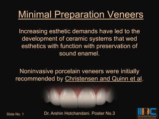 Minimal Preparation Veneers
       Increasing esthetic demands have led to the
        development of ceramic systems that wed
        esthetics with function with preservation of
                      sound enamel.

       Noninvasive porcelain veneers were initially
     recommended by Christensen and Quinn et al.




Slide No. 1     Dr. Arshin Hotchandani. Poster No.3
 