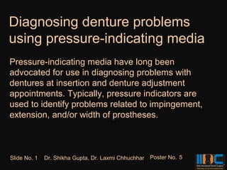 Diagnosing denture problems
using pressure-indicating media
Pressure-indicating media have long been
advocated for use in diagnosing problems with
dentures at insertion and denture adjustment
appointments. Typically, pressure indicators are
used to identify problems related to impingement,
extension, and/or width of prostheses.



Slide No. 1   Dr. Shikha Gupta, Dr. Laxmi Chhuchhar   Poster No. 5
 