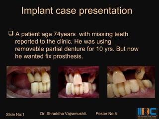 Implant case presentation

  A patient age 74years with missing teeth
   reported to the clinic. He was using
   removable partial denture for 10 yrs. But now
   he wanted fix prosthesis.




Slide No:1   Dr. Shraddha Vajramushti.   Poster No:8
 