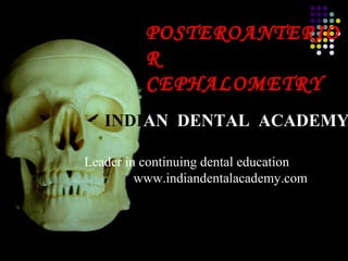 POSTEROANTERIO
R
CEPHALOMETRY

INDIAN DENTAL ACADEMY
Leader in continuing dental education
www.indiandentalacademy.com

www.indiandentalacademy.com

 