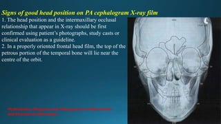 Signs of good head position on PA cephalogram X-ray film
1. The head position and the intermaxillary occlusal
relationship that appear in X-ray should be first
confirmed using patient’s photographs, study casts or
clinical evaluation as a guideline.
2. In a properly oriented frontal head film, the top of the
petrous portion of the temporal bone will lie near the
centre of the orbit.
Orthodontics: Diagnosis and Management of Malocclusion
and Dentofacial Deformities
 