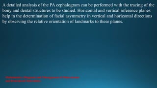 A detailed analysis of the PA cephalogram can be performed with the tracing of the
bony and dental structures to be studied. Horizontal and vertical reference planes
help in the determination of facial asymmetry in vertical and horizontal directions
by observing the relative orientation of landmarks to these planes.
Orthodontics: Diagnosis and Management of Malocclusion
and Dentofacial Deformities
 