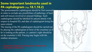 Some important landmarks used in
PA cephalogram (Figs 18.1,18.2)
The posteroanterior cephalogram should be first assessed
in order to exclude any possibilities of pathology of hard
and soft tissues involved or unusual findings. Each
cephalogram should be labelled for patient details with
respect to hospital ID, and date of cephalogram being the
most critical.
The tracing of the PA cephalogram should be carried out
by placing the cephalogram in front of the examiner as if
he is looking at the patient, i.e. patient’s right should be
on the examiner’s left. Tracing may begin with the
midline structures.
Orthodontics: Diagnosis and Management of Malocclusion
and Dentofacial Deformities
 