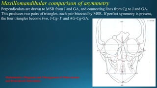 Maxillomandibular comparison of asymmetry
Perpendiculars are drawn to MSR from J and GA, and connecting lines from Cg to J and GA.
This produces two pairs of triangles, each pair bisected by MSR. If perfect symmetry is present,
the four triangles become two, J-Cg- J’ and AG-Cg-GA.
Orthodontics: Diagnosis and Management of Malocclusion
and Dentofacial Deformities
 