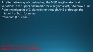 An alternative way of constructing the MSR line,if anatomical
variations in the upper and middle facial regions exist, is to draw a line
from the midpoint of Z-plane either through ANS or through the
midpoint of both foramina
rotundum (Fr-Fr line).
ORTHODONTIC CEPHALOMETRY
Edited by Athanasios E Athanasiou
 
