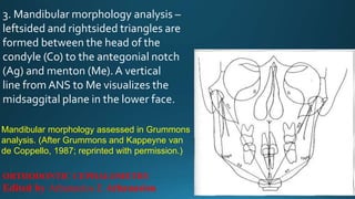 3. Mandibular morphology analysis –
leftsided and rightsided triangles are
formed between the head of the
condyle (Co) to the antegonial notch
(Ag) and menton (Me). A vertical
line from ANS to Me visualizes the
midsaggital plane in the lower face.
Mandibular morphology assessed in Grummons
analysis. (After Grummons and Kappeyne van
de Coppello, 1987; reprinted with permission.)
ORTHODONTIC CEPHALOMETRY
Edited by Athanasios E Athanasiou
 