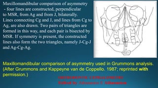 Maxillomandibular comparison of asymmetry
- four lines are constructed, perpendicular
to MSR, from Ag and from J, bilaterally.
Lines connecting Cg and J, and lines from Cg to
Ag, are also drawn. Two pairs of triangles are
formed in this way, and each pair is bisected by
MSR. If symmetry is present, the constructed
lines also form the two triangles, namely J-Cg-J
and Ag-Cg-Ag.
Maxillomandibular comparison of asymmetry used in Grummons analysis.
(After Grummons and Kappeyne van de Coppello. 1987; reprinted with
permission.)
ORTHODONTIC CEPHALOMETRY
Edited by Athanasios E Athanasiou
 