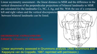 Linear asymmetry assessment - the linear distance to MSR and the difference in the
vertical dimension of the perpendicular projections of bilateral landmarks to MSR
are calculated for the landmarks Co, NC, J, Ag, and Me. With the use of a computer,
left and right values and the vertical discrepancies
between bilateral landmarks can be listed.
Linear asymmetry assessed in Grummons analysis. (After Grummons and
Kappeyne van de Coppello, 1987; reprinted with permission.)
ORTHODONTIC CEPHALOMETRY
Edited by Athanasios E Athanasiou
 