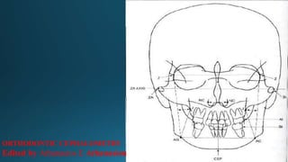 ORTHODONTIC CEPHALOMETRY
Edited by Athanasios E Athanasiou
 