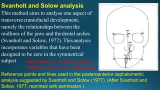 Svanholt and Solow analysis
This method aims to analyse one aspect of
transversecraniofacial development,
namely the relationshipsbetween the
midlines of the jaws and thedental arches
(Svanholt and Solow, 1977). Thisanalysis
incorporates variables that have been
designed to be zero in the symmetrical
subject
Reference points and lines used in the posteroanterior cephalometric
analysis suggested by Svanholt and Solow (1977). (After Svanholt and
Solow. 1977; reprinted with permission.)
ORTHODONTIC CEPHALOMETRY
Edited by Athanasios E Athanasiou
 