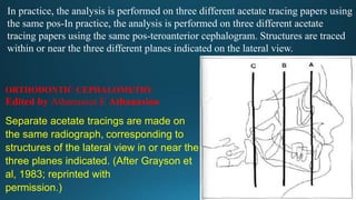 In practice, the analysis is performed on three different acetate tracing papers using
the same pos-In practice, the analysis is performed on three different acetate
tracing papers using the same pos-teroanterior cephalogram. Structures are traced
within or near the three different planes indicated on the lateral view.
Separate acetate tracings are made on
the same radiograph, corresponding to
structures of the lateral view in or near the
three planes indicated. (After Grayson et
al, 1983; reprinted with
permission.)
ORTHODONTIC CEPHALOMETRY
Edited by Athanasios E Athanasiou
 