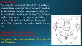 Hewitt analysis
According to this method (Hewitt, 1975), analysis
of craniofacial asymmetry is performed by dividing
the craniofacial complex in constructed triangles,
the so-called triangulation of the face. The different
angles, triangles and component areas can be
compared for both the left side and the right side
(6.28). The regions that can be described in this way
are:
Triangulation of the face. (After Hewitt, 1975; reprinted
with permission
ORTHODONTIC CEPHALOMETRY
Edited by Athanasios E Athanasiou
 