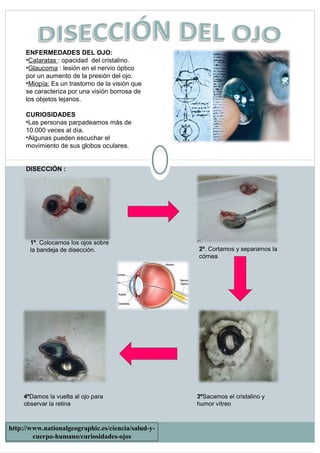 http://www.nationalgeographic.es/ciencia/salud-y-
cuerpo-humano/curiosidades-ojos
1º. Colocamos los ojos sobre
la bandeja de disección. 2º. Cortamos y separamos la
córnea.
3ºSacamos el cristalino y
humor vítreo
4ºDamos la vuelta al ojo para
observar la retina
ENFERMEDADES DEL OJO:
•Cataratas : opacidad del cristalino.
•Glaucoma : lesión en el nervio óptico
por un aumento de la presión del ojo.
•Miopía: Es un trastorno de la visión que
se caracteriza por una visión borrosa de
los objetos lejanos.
CURIOSIDADES
•Las personas parpadeamos más de
10.000 veces al día.
•Algunas pueden escuchar el
movimiento de sus globos oculares.
DISECCIÓN :
 