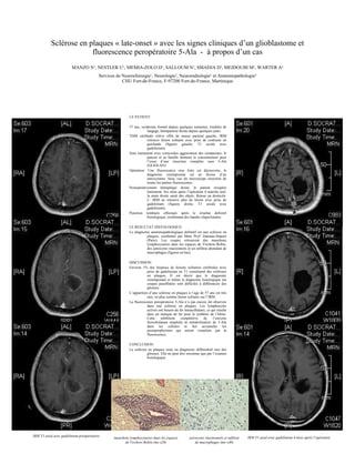 Sclérose en plaques « late-onset » avec les signes cliniques d’un glioblastome et fluorescence peropératoire 5-Ala  -  à propos d’un cas MANZO N 1 , NESTLER U 1 , MEMIA-ZOLO D 1 , SALLOUM N 1 , SMADJA D 2 , MEJDOUBI M 3 , WARTER A 4 Services de Neurochirurgie 1 , Neurologie 2 , Neuroradiologie 3  et Anatomopathologie 4 CHU Fort-de-France, F-97200 Fort-de-France, Martinique ,[object Object],[object Object],[object Object],[object Object],[object Object],[object Object],[object Object],[object Object],[object Object],[object Object],[object Object],[object Object],[object Object],[object Object],[object Object],IRM T1 axial avec gadolinium préopératoire IRM T1 axial avec gadolinium 6 mois après l’opération manchons lymphocytaires dans les espaces de Virchow-Robin (mo x20) astrocytes réactionnels et infiltrat  de macrophages (mo x40) 