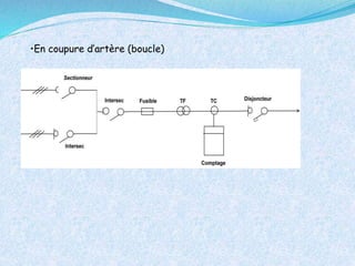 •En coupure d’artère (boucle)
 