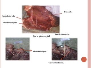 Corte parasagital
Válvula tricúspide
Ventrículo derecho
Auricula derecha
Trabeculas
Válvula bicúspide
Cuerdas tendinosas.
 