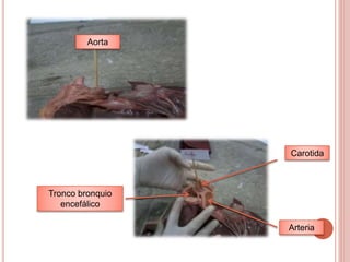 Aorta
Carotida
Arteria
Tronco bronquio
encefálico
 