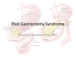 Post Gastrectomy Syndrome
Kusuma Chinaroonchai, MD.

 