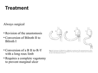 2 Roux postgastrectomy syndromes , topic from ms gen surgery | PPTX