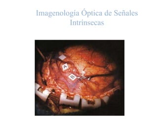 Imagenología Óptica de Señales
Intrínsecas
 