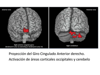 Proyección del Giro Cingulado Anterior derecho.
Activación de áreas corticales occipitales y cerebelo
 