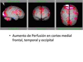 • Aumento de Perfusión en cortex medial
frontal, temporal y occipital
 