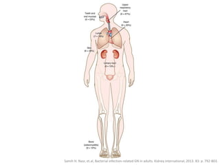 Samih H. Nasr, et.al, Bacterial infection-related GN in adults. Kidney international, 2013. 83: p. 792-803.
 