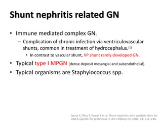 Shunt nephritis related GN
• Immune mediated complex GN.
– Complication of chronic infection via ventriculovascular
shunts, common in treatment of hydrocephalus.(1)
• In contrast to vascular shunt, VP shunt rarely developed GN.
• Typical type I MPGN (dense deposit mesangial and subendothelial).
• Typical organisms are Staphylococcus spp.
Iwata Y, Ohta S, Kawai K et al. Shunt nephritis with positive titers for
ANCA specific for proteinase 3. Am J Kidney Dis 2004; 43: e11–e16.
 