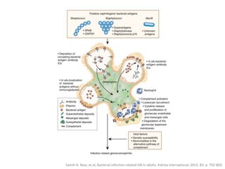 Samih H. Nasr, et.al, Bacterial infection-related GN in adults. Kidney international, 2013. 83: p. 792-803.
 