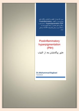 ‫بعد‬ ‫لک‬ ‫بروز‬‫التهاب‬ ‫از‬‫ی‬‫ا‬‫افزا‬‫ی‬‫ش‬‫ها‬ ‫رنگدانه‬‫ی‬
‫پوست‬‫ی‬‫التهاب‬ ‫از‬ ‫پس‬Postinflammatory
hyperpigmentation (PIH‫و‬ ‫ازعوارض‬ (
‫درگ‬‫ی‬‫ر‬‫ی‬‫ها‬‫ی‬‫شا‬ ‫نسبتا‬ ‫و‬ ‫متداول‬‫ی‬‫ع‬‫به‬ ‫پوست‬
‫برخ‬ ‫بروز‬ ‫واسطه‬‫ی‬‫ب‬‫ی‬‫مار‬‫ی‬‫ها‬‫ی‬‫ا‬‫درمان‬ ‫اقدامات‬‫ی‬
.‫است‬
Postinflammatory
hyperpigmentation
(PIH(
‫ها‬‫ی‬‫پر‬‫پ‬‫ی‬‫گمنت‬‫ی‬‫شن‬‫التهاب‬ ‫از‬ ‫بعد‬
Dr.Mohammad Baghaei
FACEDOUX
 