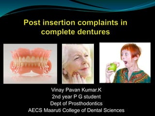 Vinay Pavan Kumar.K
2nd year P G student
Dept of Prosthodontics
AECS Maaruti College of Dental Sciences
 