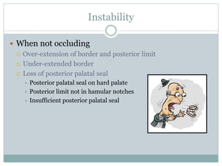 Instability
 When not occluding
 Over-extension of border and posterior limit
 Under-extended border
 Loss of posterior palatal seal
 Posterior palatal seal on hard palate
 Posterior limit not in hamular notches
 Insufficient posterior palatal seal
 
