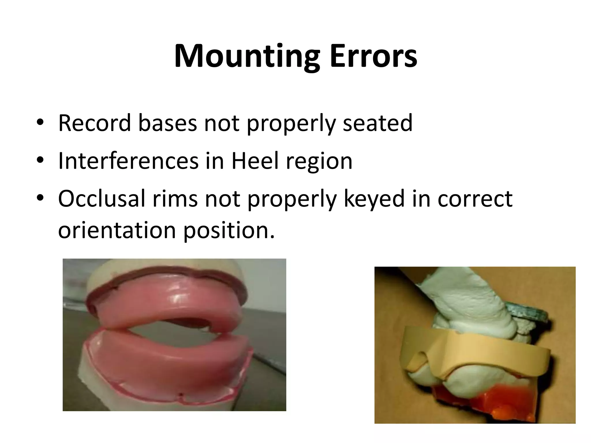 Mounting Errors
• Record bases not properly seated
• Interferences in Heel region
• Occlusal rims not properly keyed in correct
orientation position.
 