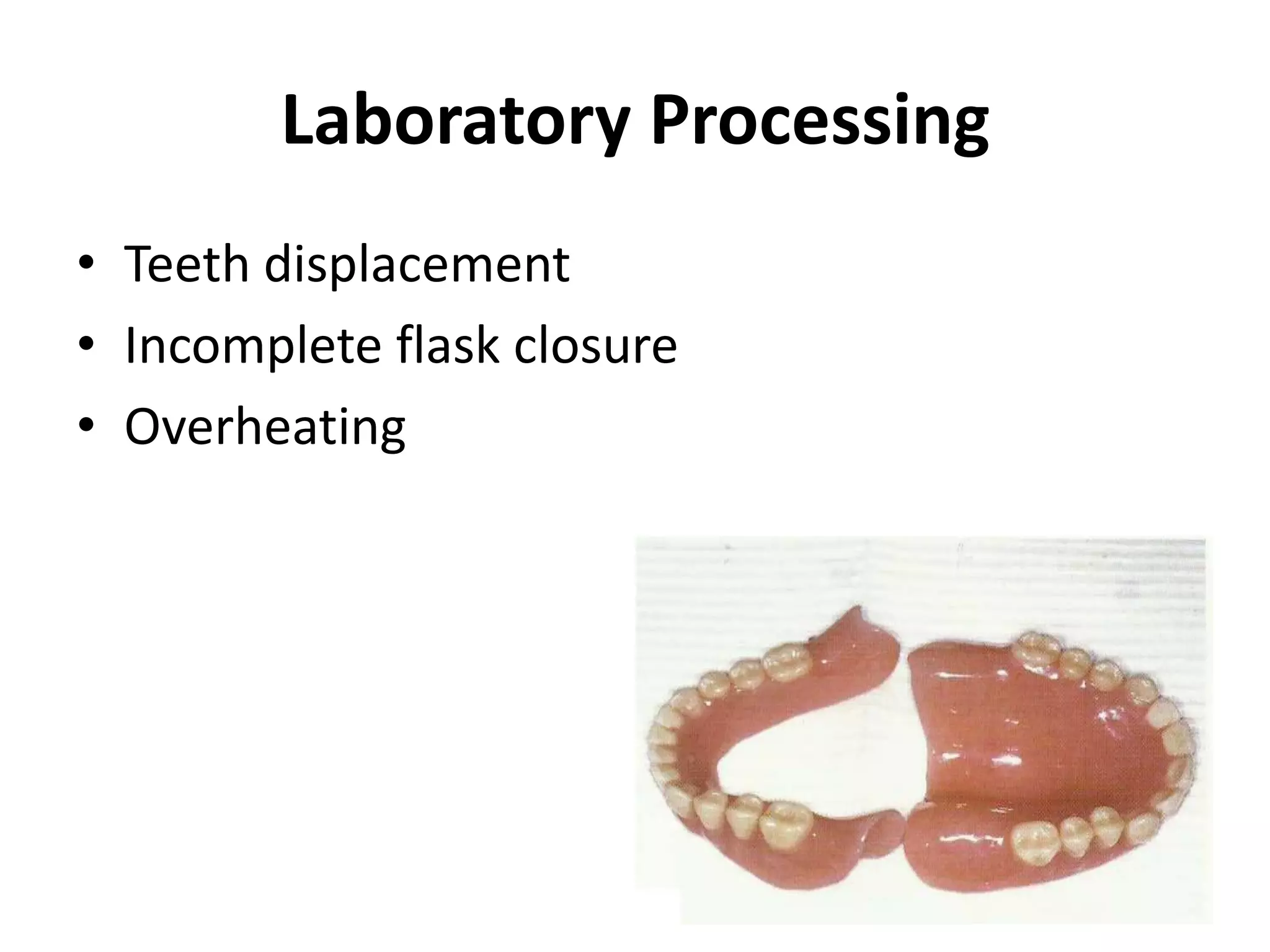Laboratory Processing
• Teeth displacement
• Incomplete flask closure
• Overheating
 